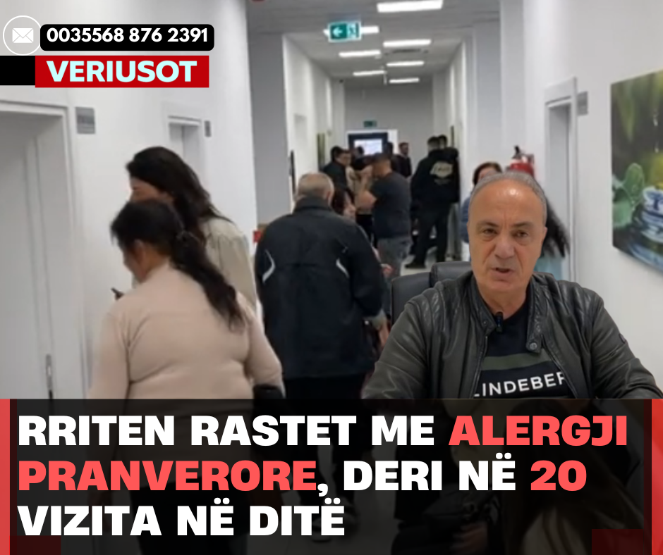 Rriten rastet me alergji pranverore, deri në 20 vizita në ditë